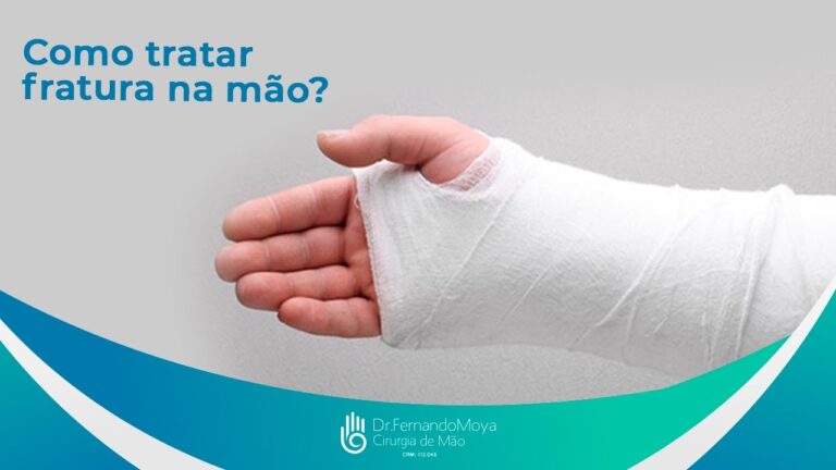Tempo de Recuperação da Fratura na Mão