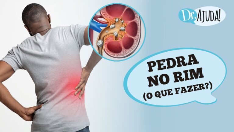 Cálculo Renal e Sua Relação com a Impotência Sexual
