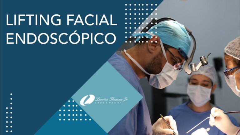 Transformações do Lifting Endoscópico: Antes e Depois