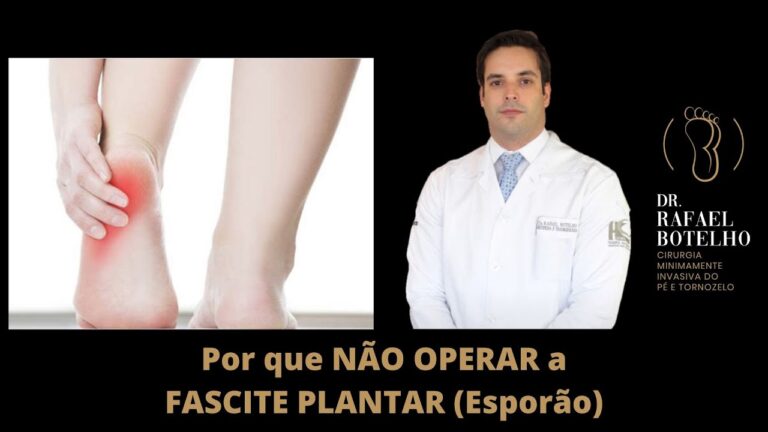Cirurgia Eficaz para Fascite Plantar