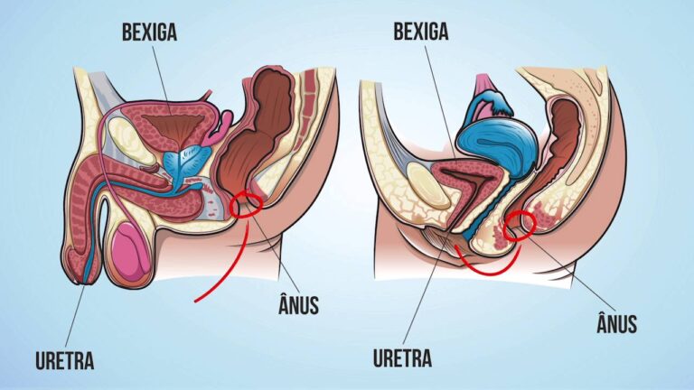 Causas da Infecção Urinária em Homens