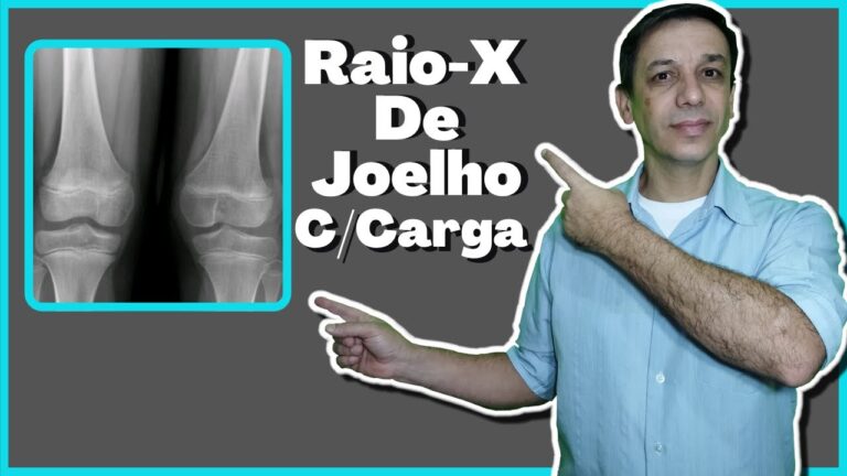 Raio X com Carga: Avanços e Aplicações