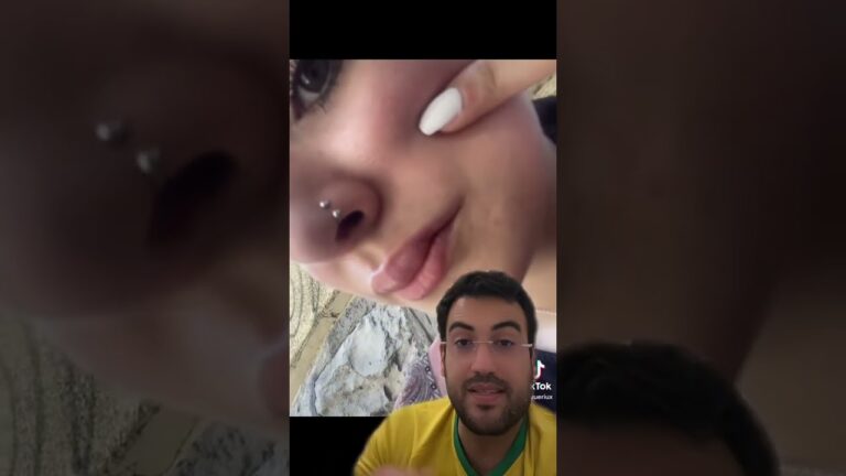 Clareamento para Gengiva Branca: Dicas e Cuidados