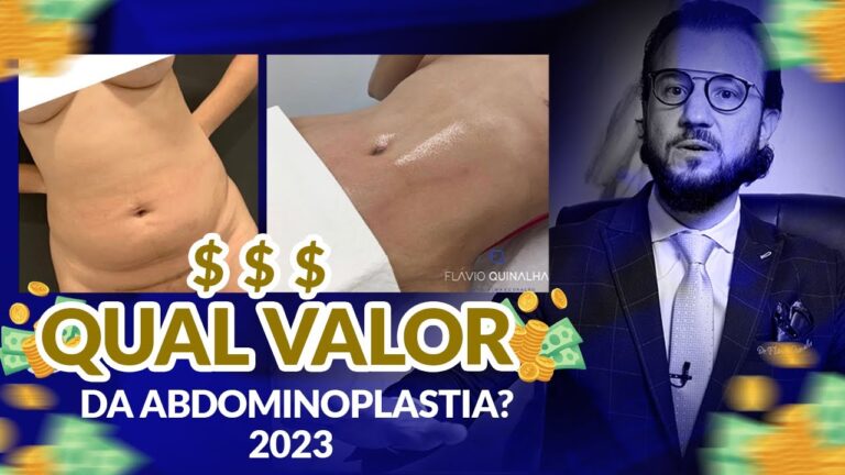 Custo da Abdominoplastia: O Que Você Precisa Saber