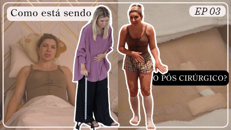 Abdominoplastia: Tempo de Repouso Ideal para Recuperação