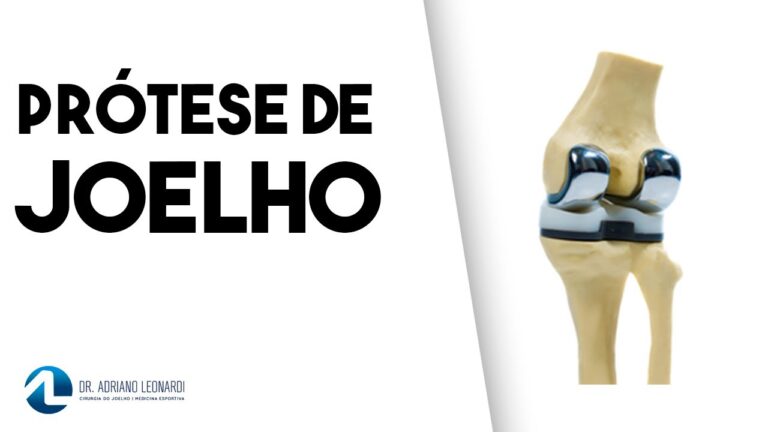Vantagens da Prótese de Joelho em Titânio