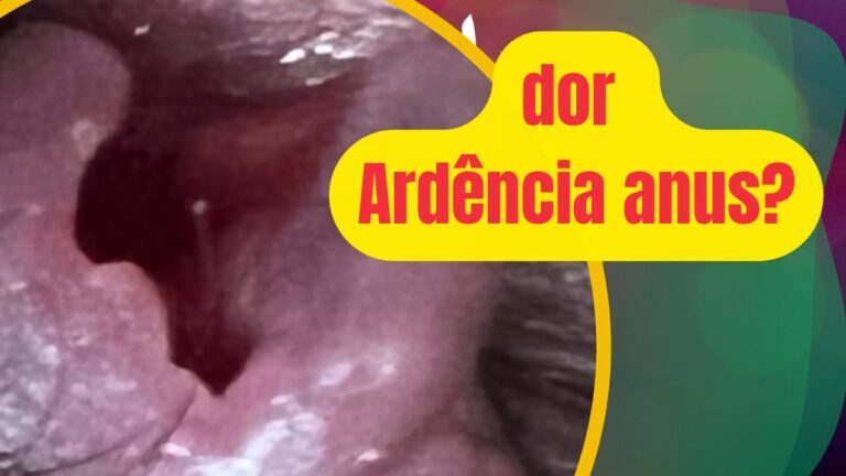 Causas e Tratamentos para Dor e Ardência no Ânus