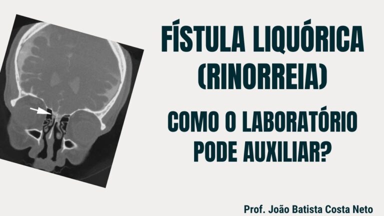 Entendendo a Rinorreia: Causas e Tratamentos