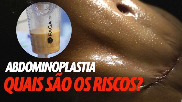 Riscos da Abdominoplastia: O Que Você Precisa Saber