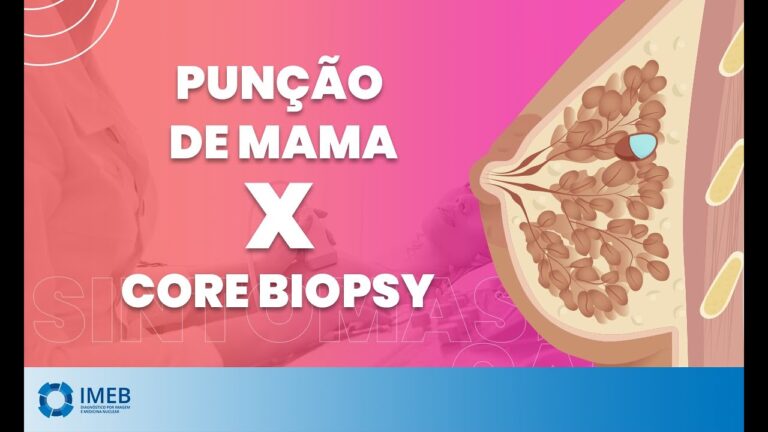 Sintomas Comuns Após Punção da Mama