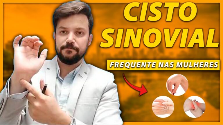 Riscos do Cisto Sinovial no Pé: O Que Você Precisa Saber