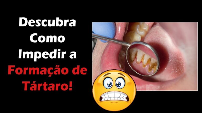 Como Prevenir o Tártaro de Forma Eficaz
