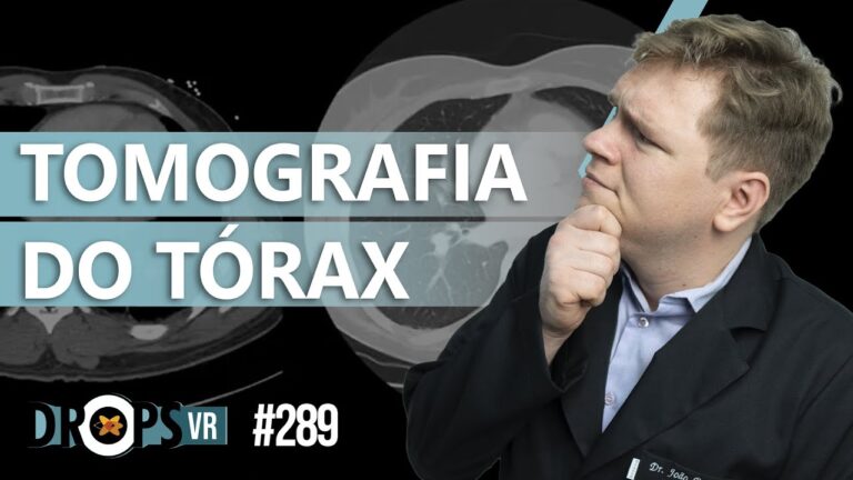 CT de Tórax: Avanços e Aplicações na Diagnóstico Médico