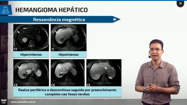 Entendendo o Nódulo Hipoatenuante: Causas e Implicações Clínicas