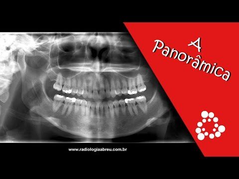 Importância da Radiografia Panorâmica nas Arcadas Dentárias
