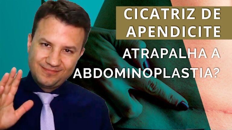 Cicatriz da Cirurgia de Apendicite: Cuidados e Estética