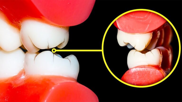 Como Parar de Rangir os Dentes Durante o Sono
