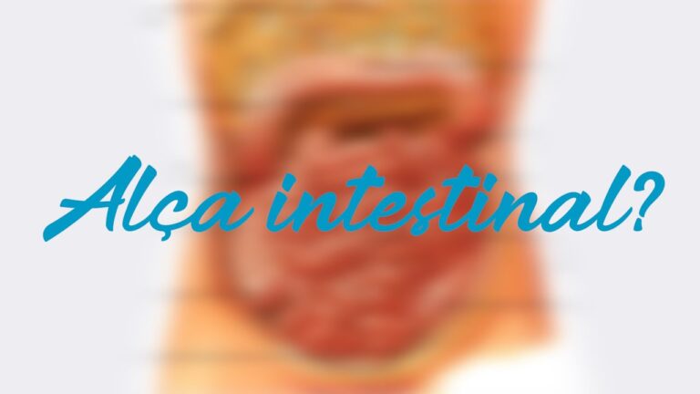 P&acirc;ncreas Parcialmente Visualizado: Impacto da Interposi&ccedil;&atilde;o de Al&ccedil;as Intestinais