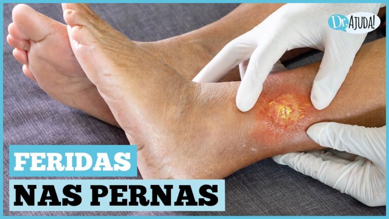 Cuidados Essenciais para Feridas na Sola do Pé
