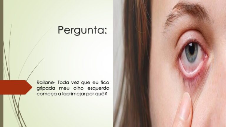 Como Aliviar o Lacrimejamento Ocular Durante a Gripe