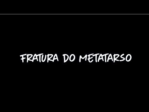 Fraturas dos Metatarsos: 2ª, 3ª e 4ª Lesões em Foco