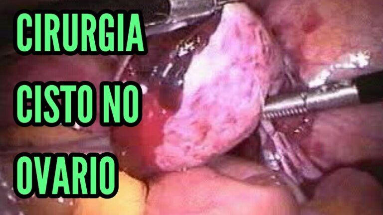 Cirurgia para Remoção de Cisto Ovariano: O Que Você Precisa Saber
