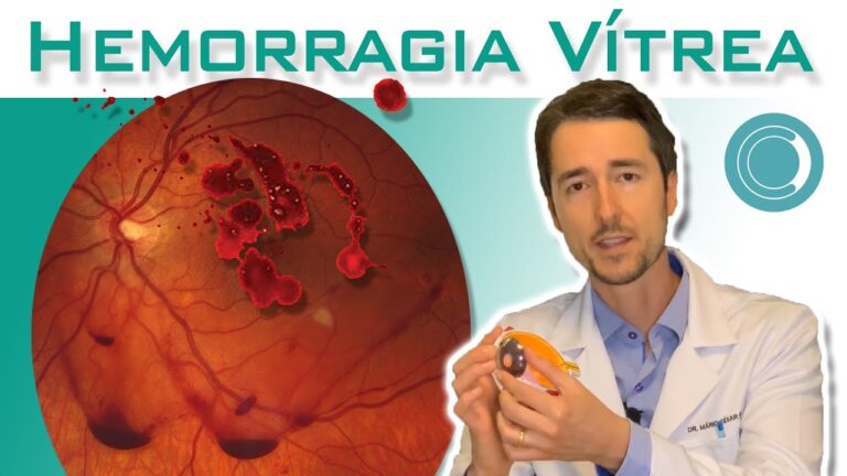 Causas e Tratamentos da Hemorragia na Retina