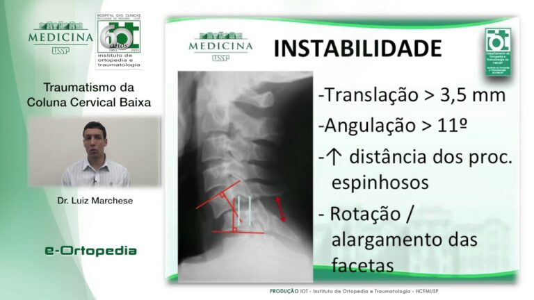 Entendendo a Les&atilde;o da Coluna Cervical C4-C5