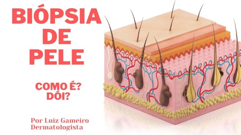 Recuperação Adequada Após Biopsia de Pele: A Importância do Repouso