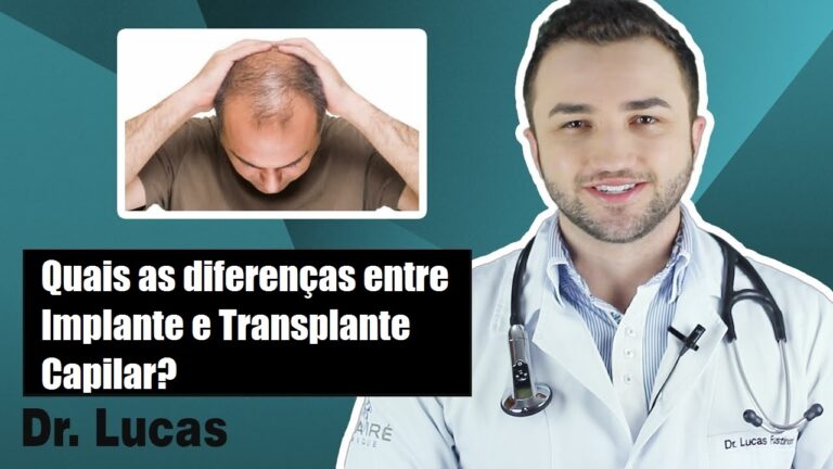 Implante vs. Transplante Capilar: Entenda as Diferenças
