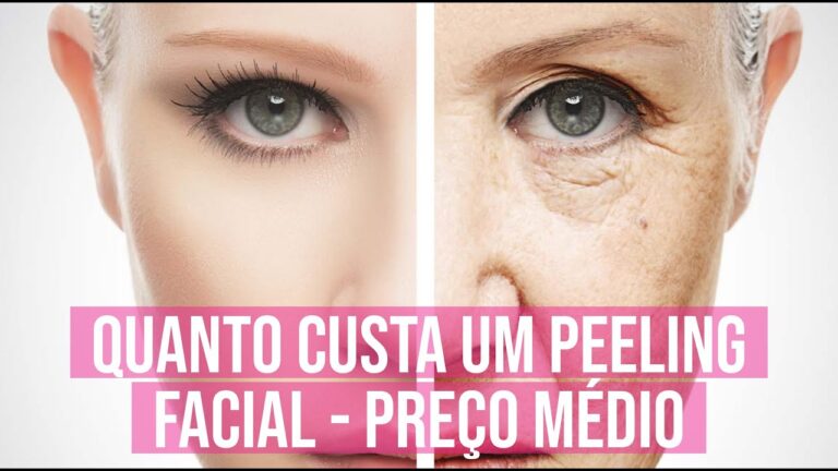 Custo do Peeling Facial: O Que Você Precisa Saber