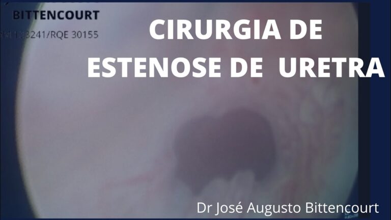 Cirurgia no Canal Urinário Masculino: Tudo que Você Precisa Saber