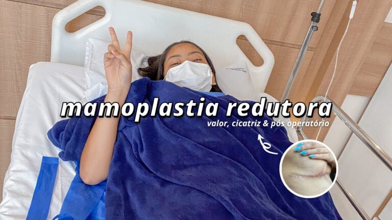 Cicatrizes de Mamoplastia: Entenda e Veja Exemplos