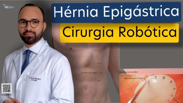 Cirurgia para Hernia Epigástrica: Abordagens e Resultados