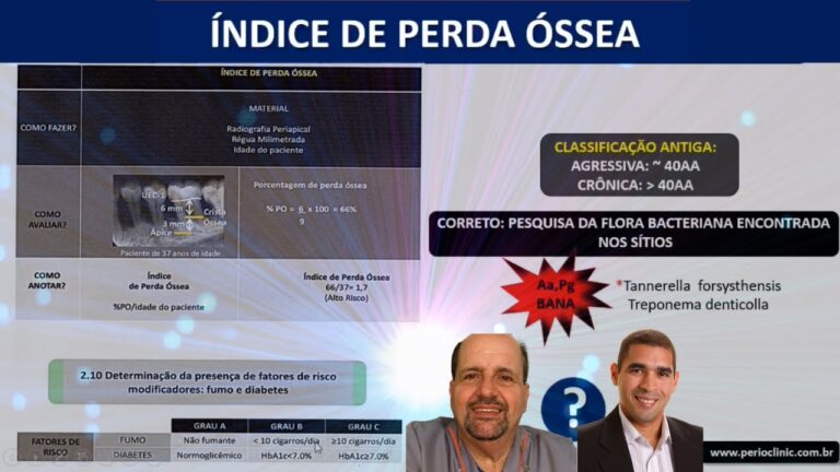 Graus de Perda Óssea Dentária: Causas e Consequências