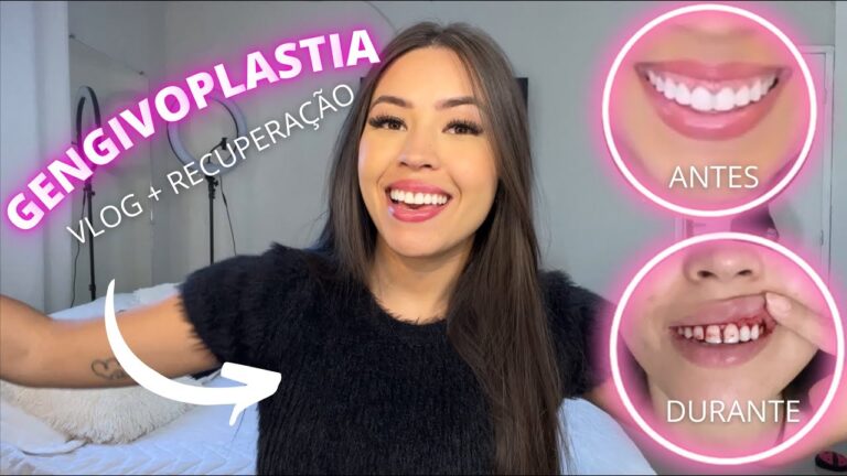 Recuperação Eficiente Após Gengivoplastia