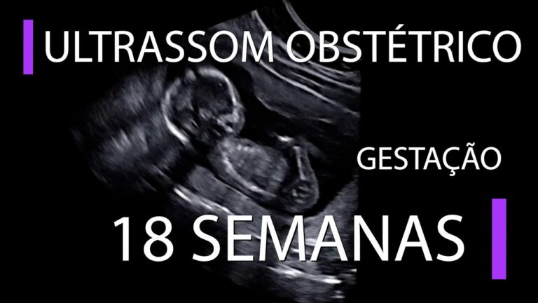 Ultrassom 3D: Descubra o Que Esperar aos 18 Semanas