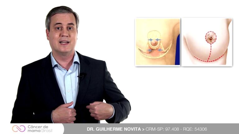 Cicatriz de Redução de Mama: Dicas para Minimizar e Cuidar