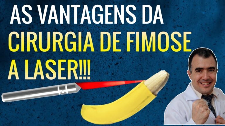 Cirurgia de Fimose a Laser: Pre&ccedil;os e Vantagens
