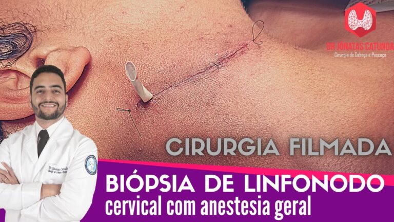 Custo da Bi&oacute;psia do Pesco&ccedil;o: O que Voc&ecirc; Precisa Saber