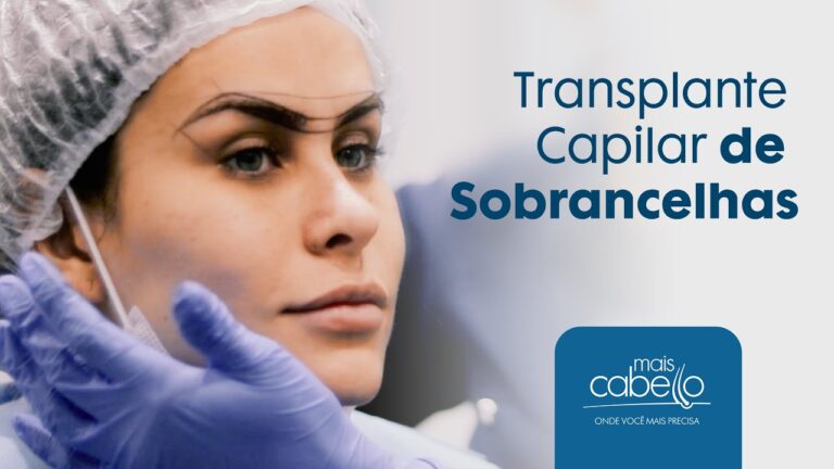 Implante de Sobrancelha: Tudo que Você Precisa Saber