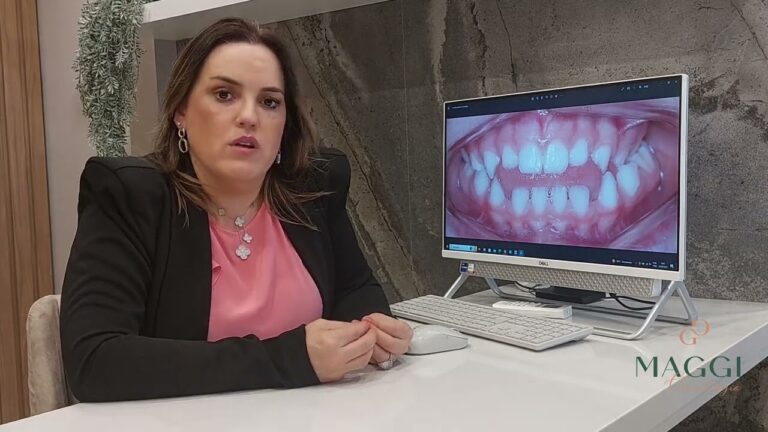 Mordida Aberta Infantil: Causas e Soluções Eficazes