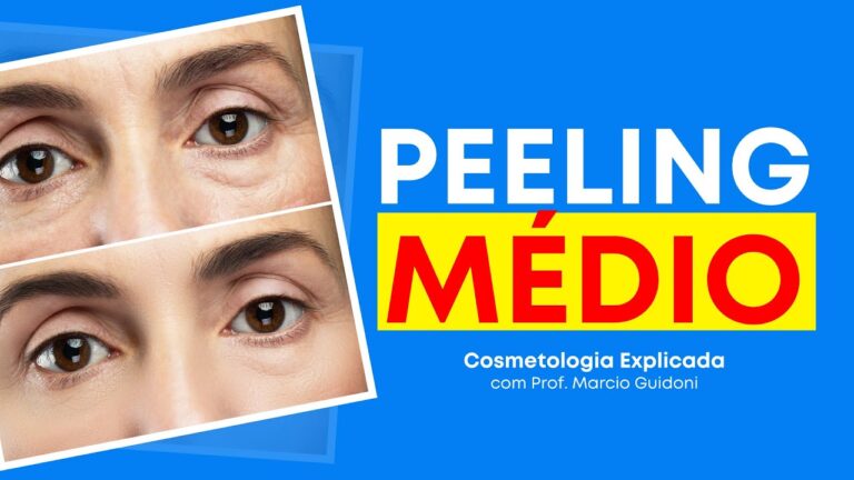Resultados do Peeling Médio: Antes e Depois