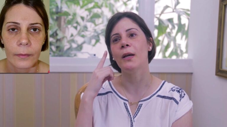 Entendendo a Ptose Palpebral Bilateral: Causas e Tratamentos