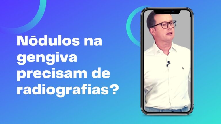 Caro&ccedil;o na Gengiva: Causas e Imagens Explicativas