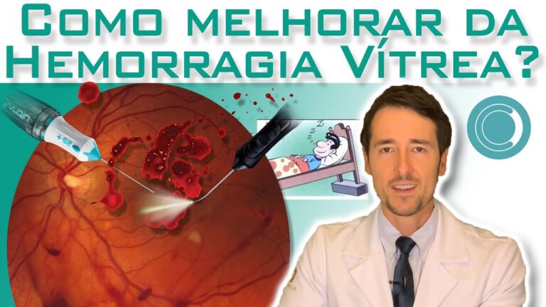Entendendo a Hemorragia Vítreo: Causas, Sintomas e Tratamentos