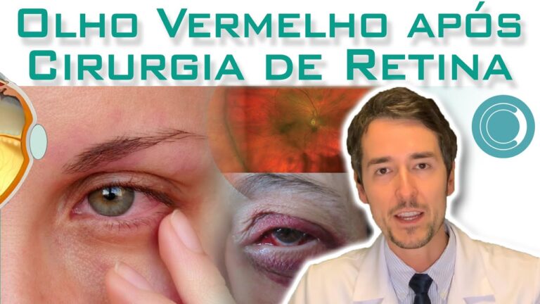 Olho Vermelho Após Cirurgia de Catarata: Causas e Cuidados