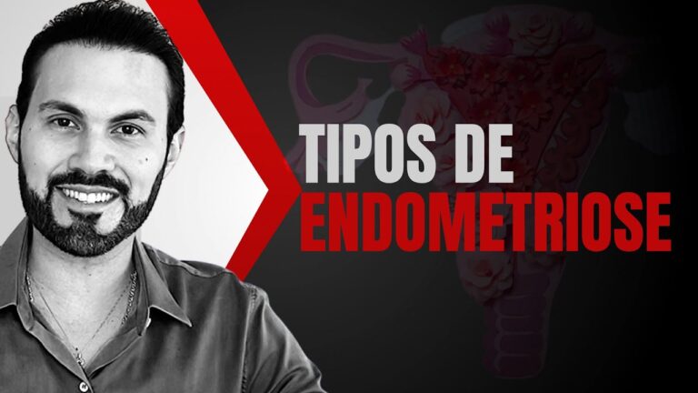 Tipos de Endometriose: Um Guia Completo
