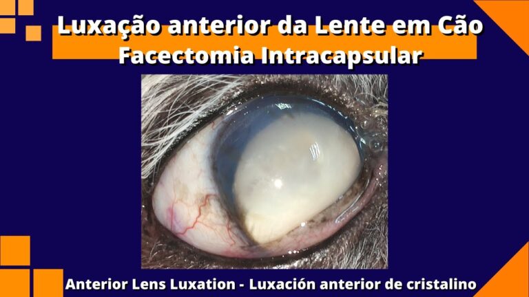 Facectomia: Entenda o Que É e Como Funciona