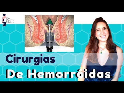 Entendendo a Operação para Hemorroidas: O Que Você Precisa Saber
